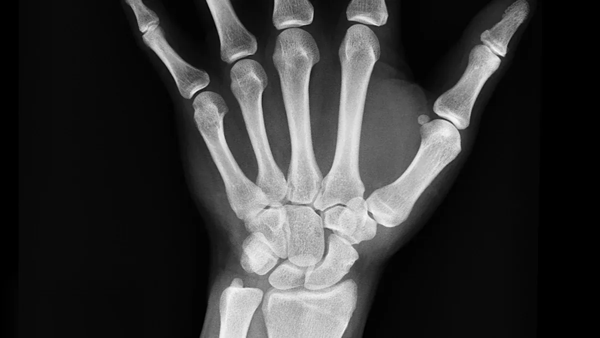 Health Benefits for Bones